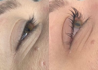 Before and after a lash- lift