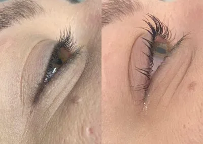 Before and after a lash- lift