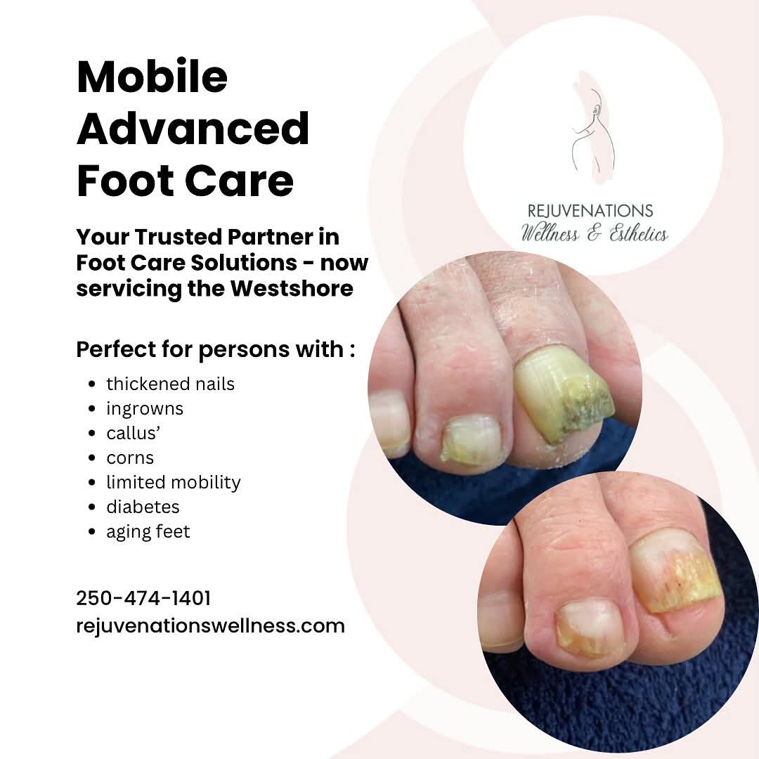 Mobile Advanced Foot Care special in Langford at Rejuvenations